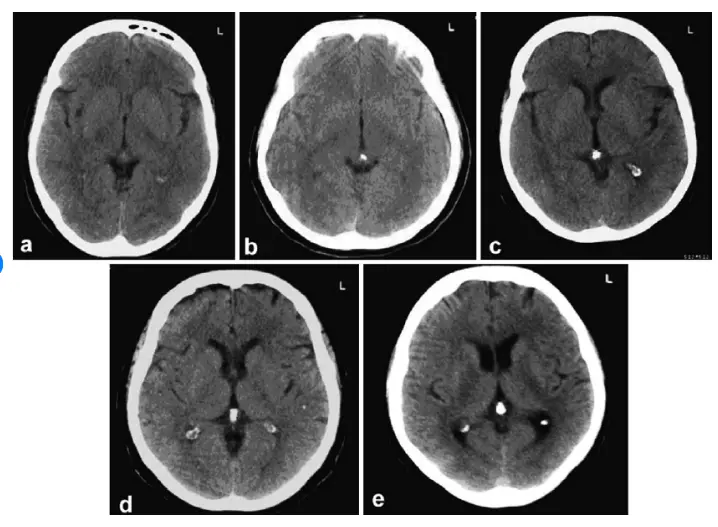 brain-scans